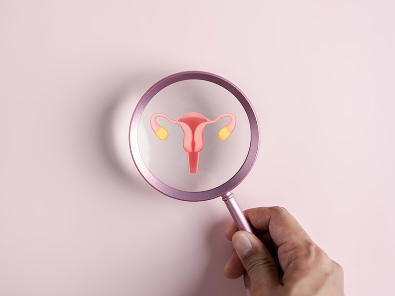 Consulta oncológica para tratamiento de cáncer de ovario y cervicouterino